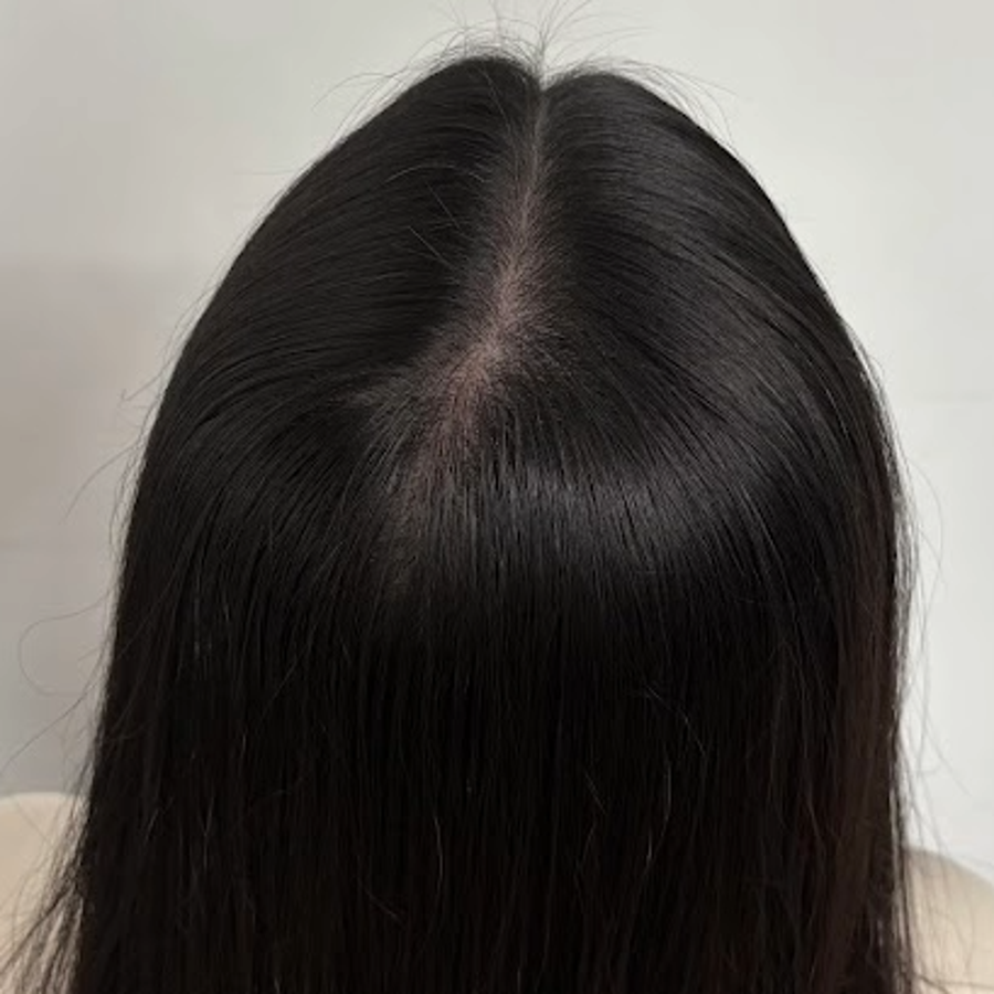 施作後2