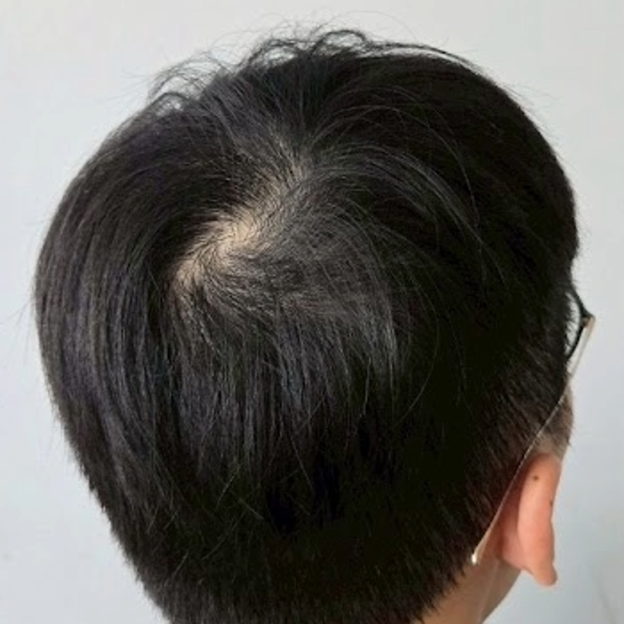 施作前