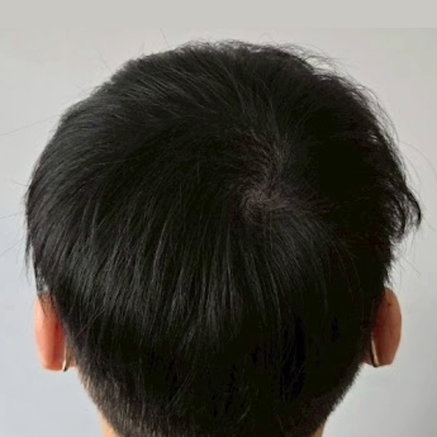 施作後2