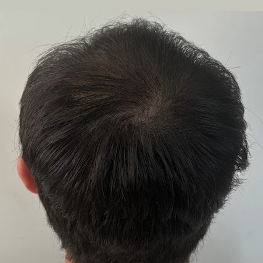 施作後2