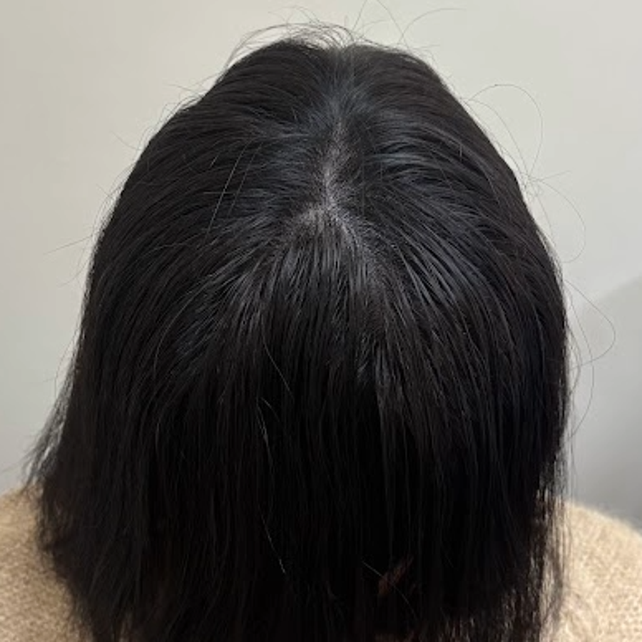 施作後