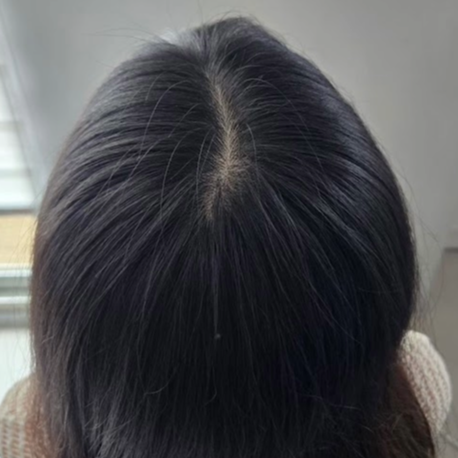 施作前2