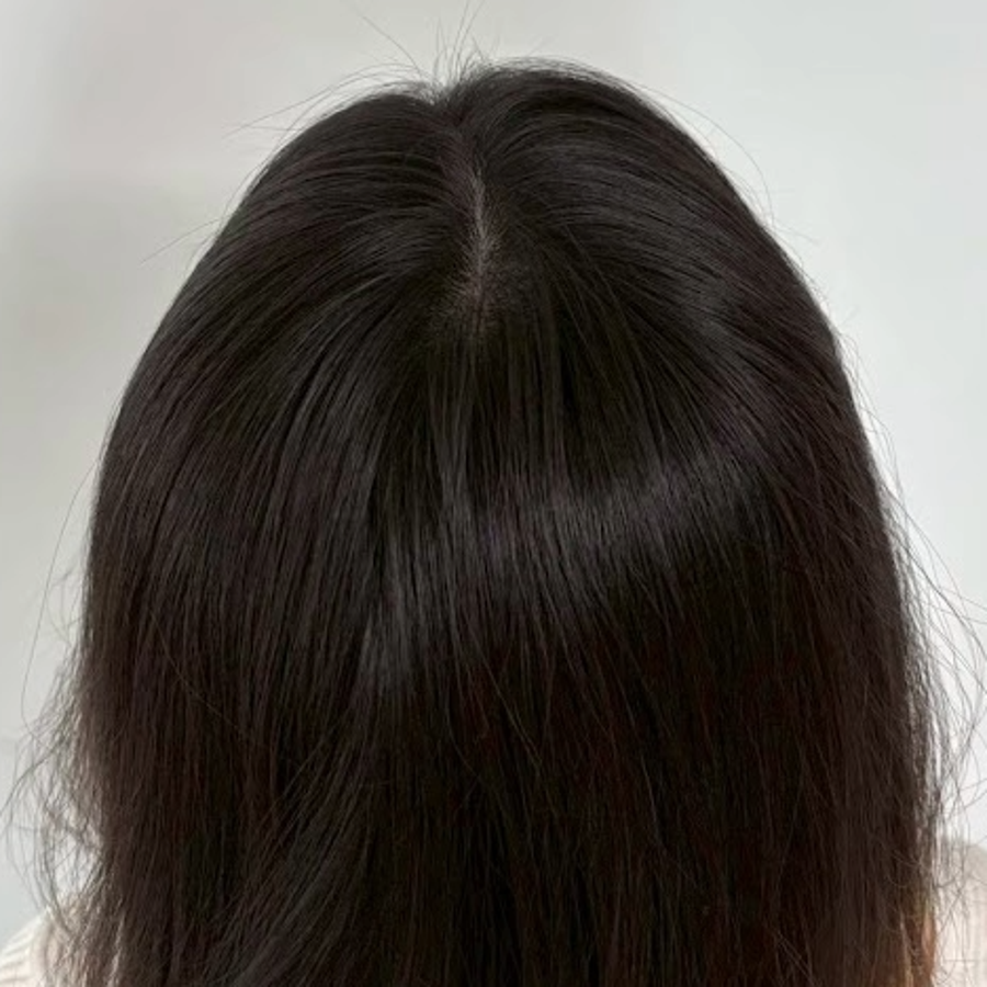 施作後2