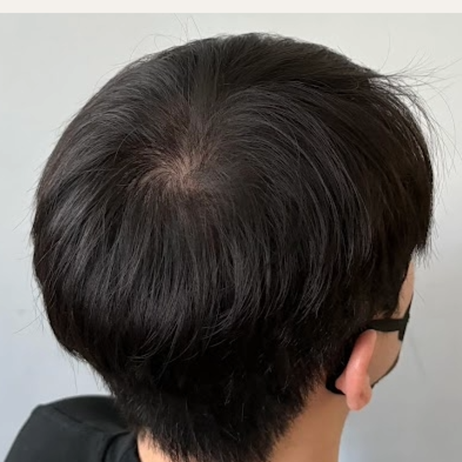 施作前 2