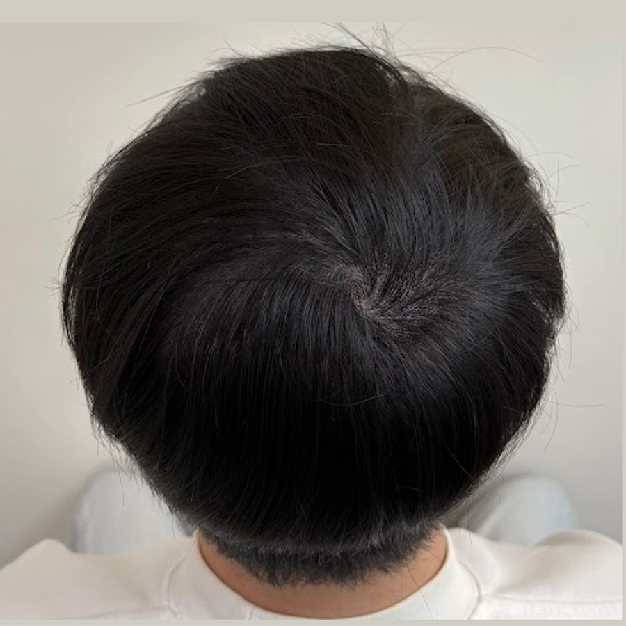 施作後 1